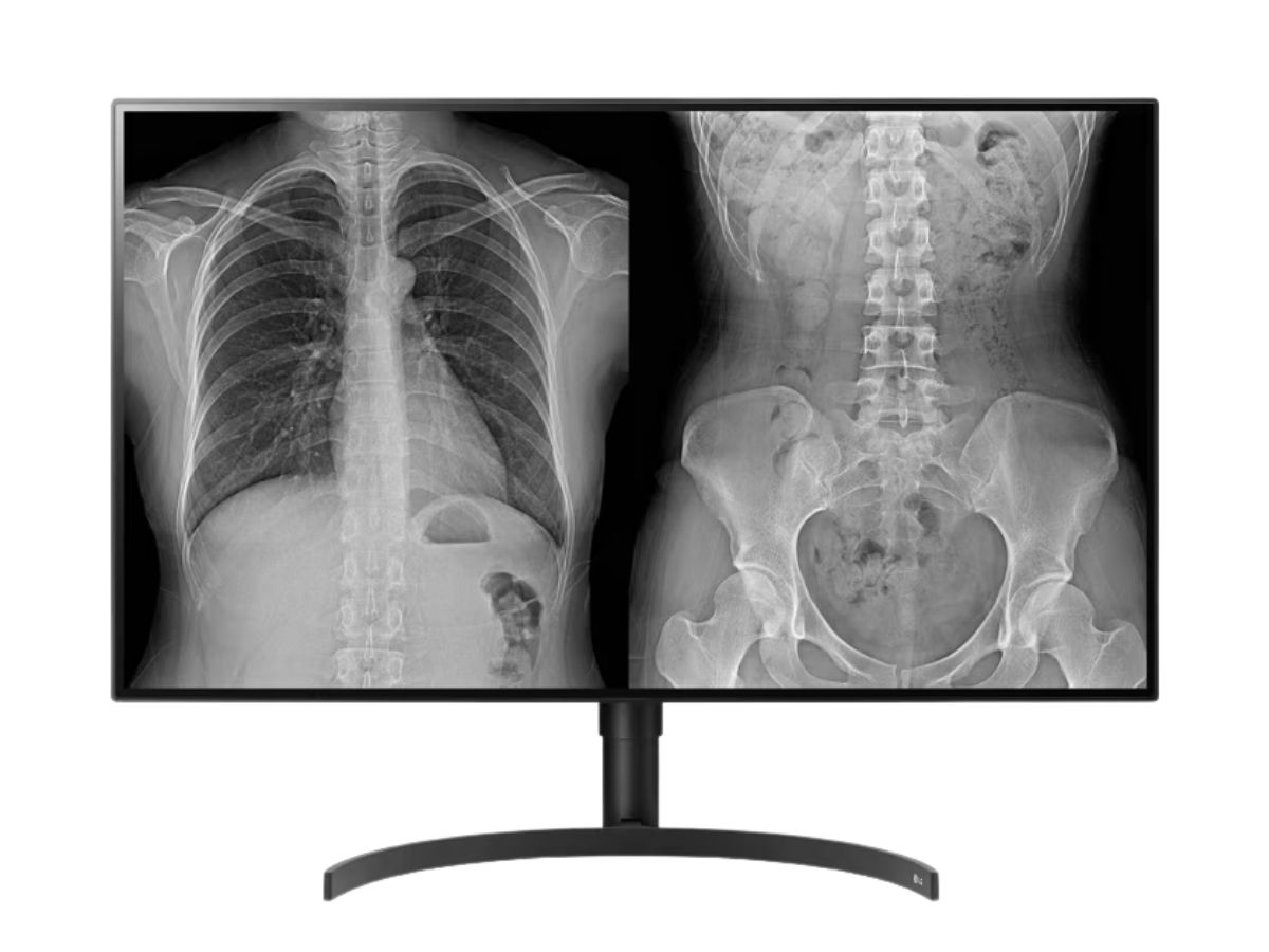 Monitor de diagnóstico IPS LG de 31.5" y 8 MP