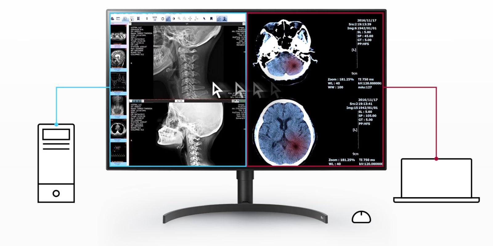 1-Monitor-diagnóstico-LG-31-1 Monitor de diagnóstico IPS LG de 31.5
