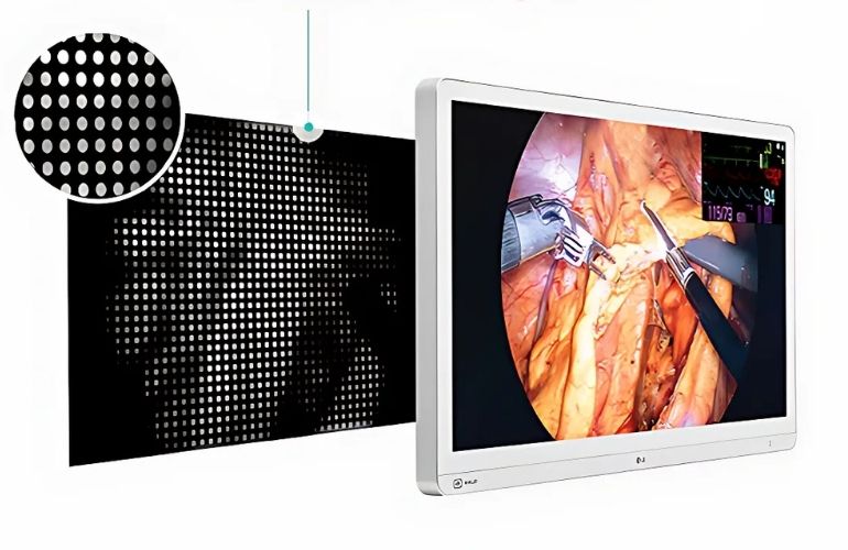 10-monitor-quirurgico-lg-4k-mini-led-31-2