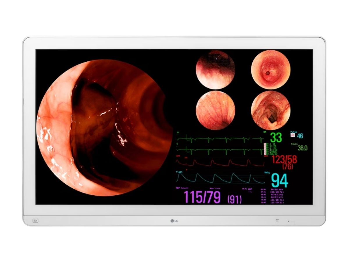 Monitor quirúrgico IPS 4K de 31,5'' de LG