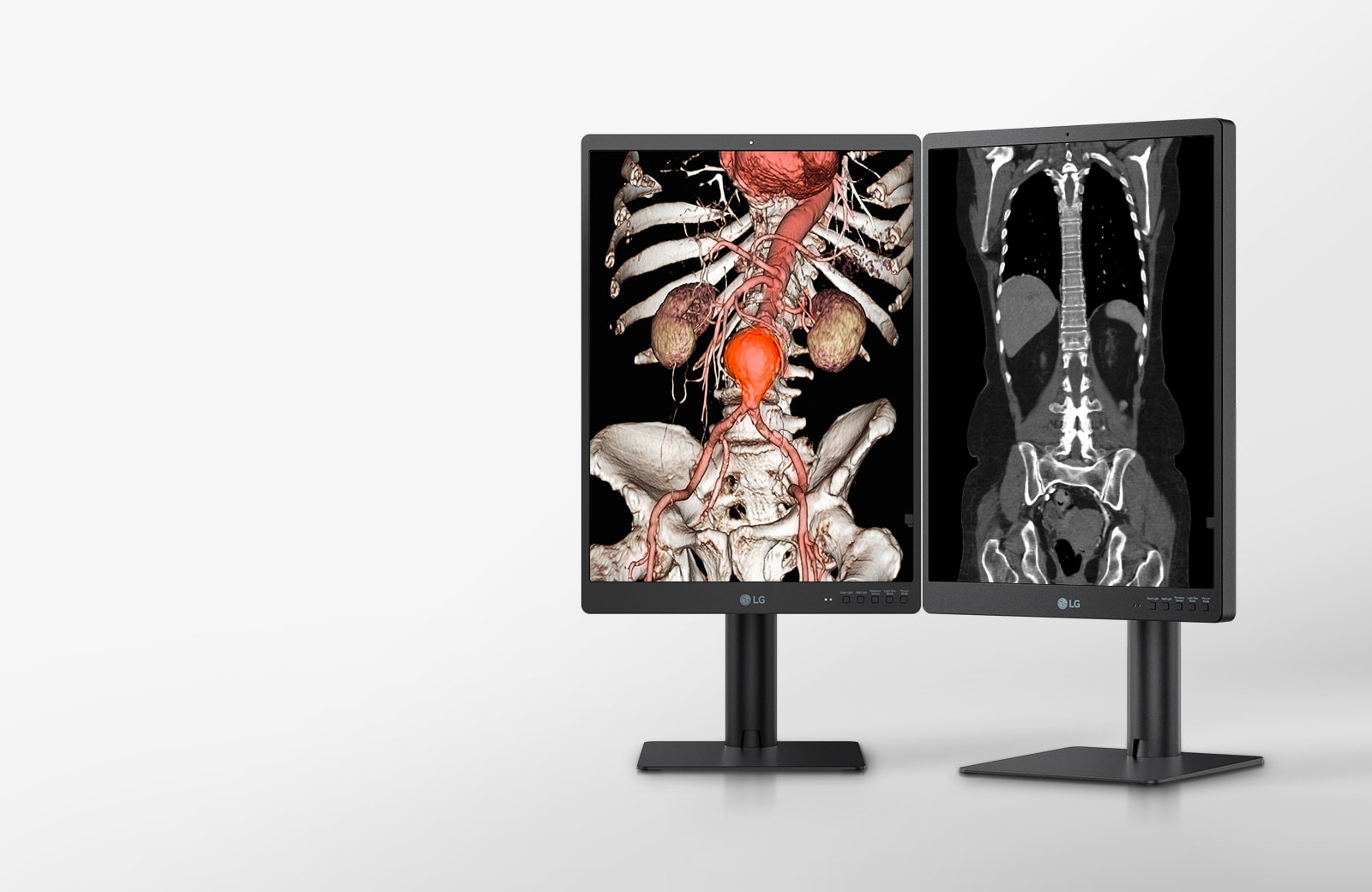 Monitor de diagnóstico IPS LG de 21,3» y 3 MP Monitor de diagnóstico IPS LG de 21,3'' y 3 MP