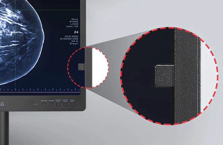 Monitor de diagnóstico IPS LG de 21,3