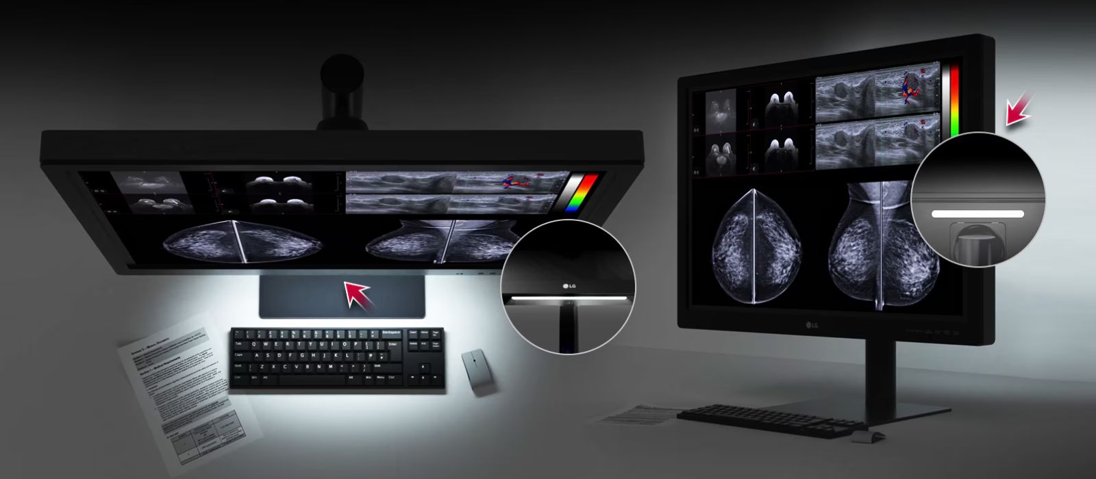 Monitor de Diagnóstico para Mamografía de 31 pulgadas y 12 MP