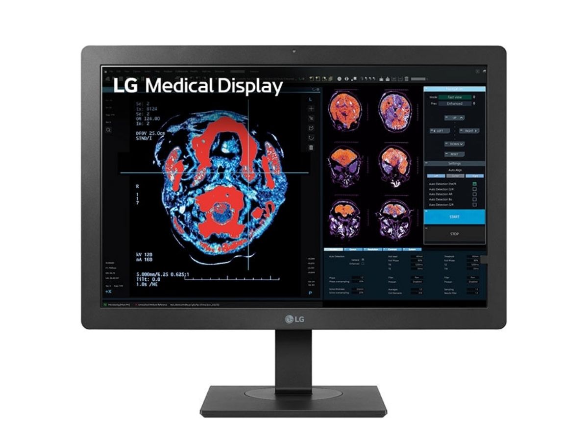 Monitor de revisión clínica IPS LG de 24'' y 2 MP
