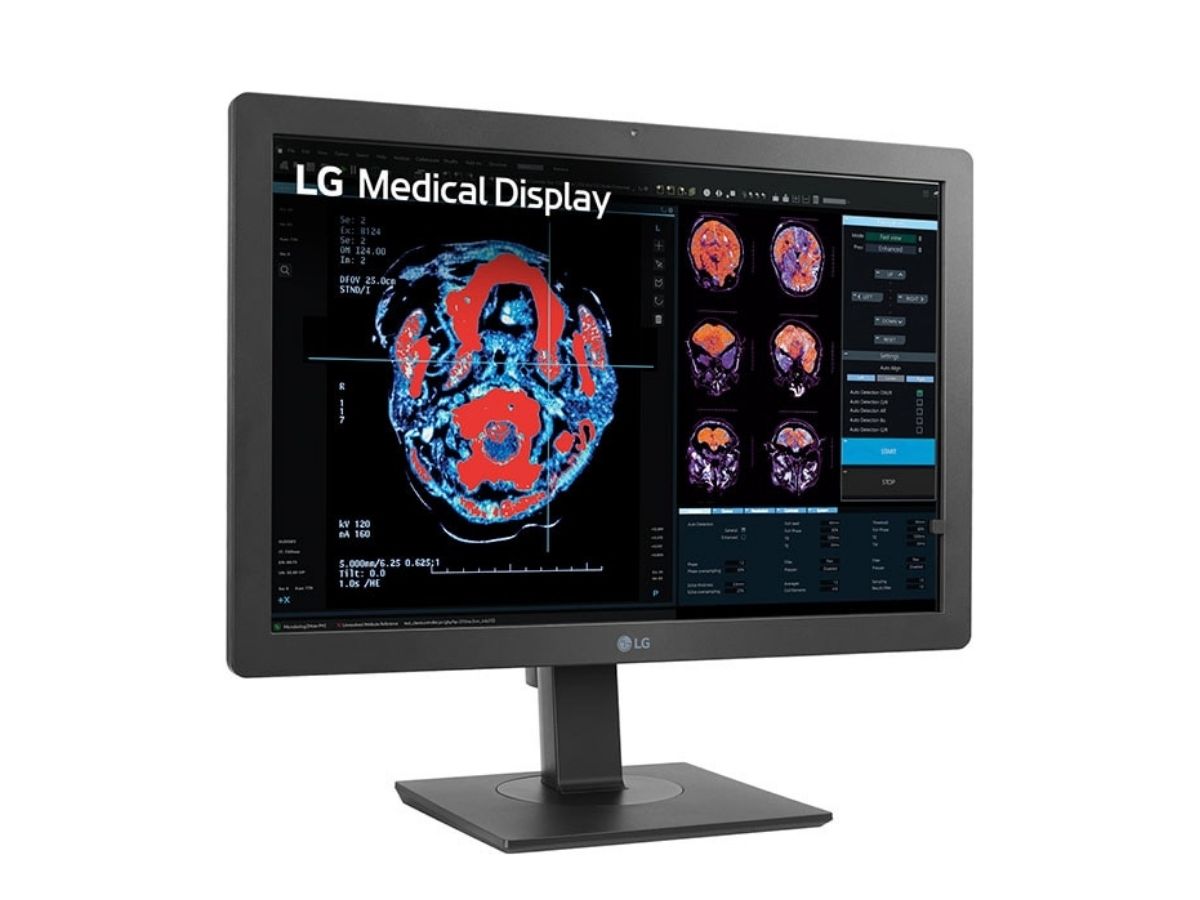 Monitor de revisión clínica IPS LG de 24'' y 2 MP - Imagen 2