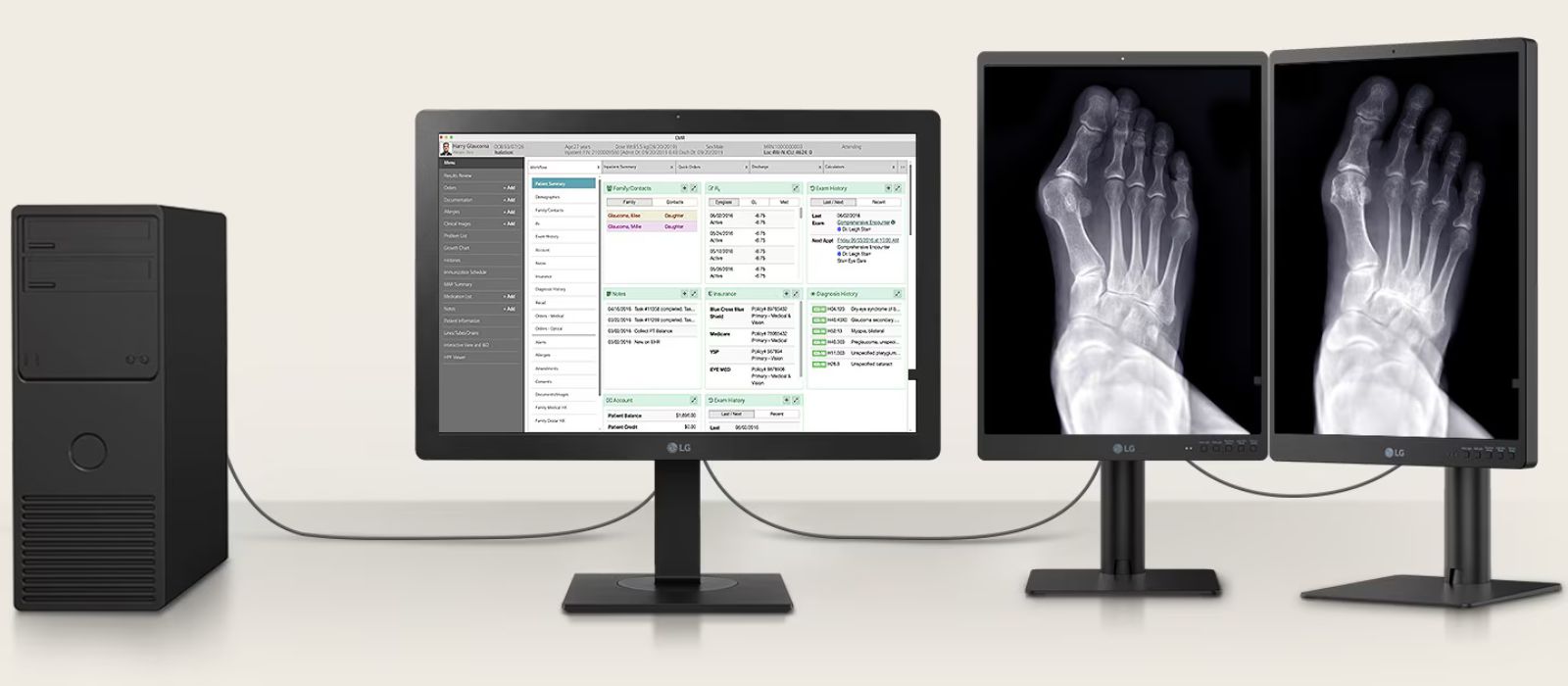 Monitor de revisión clínica IPS LG de 24» y 2 MP Monitor de diagnóstico IPS LG de 31.5