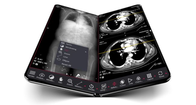 RIACS PACS: La Nueva Era en Gestión de Imagen Médica 