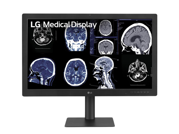 Monitores de diagnóstico y para Mamografías 