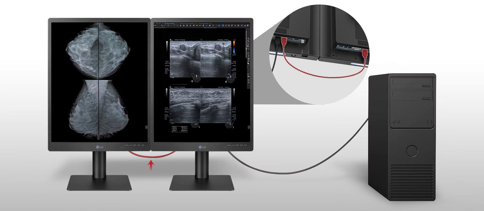 Monitor de diagnóstico IPS LG de 31.5