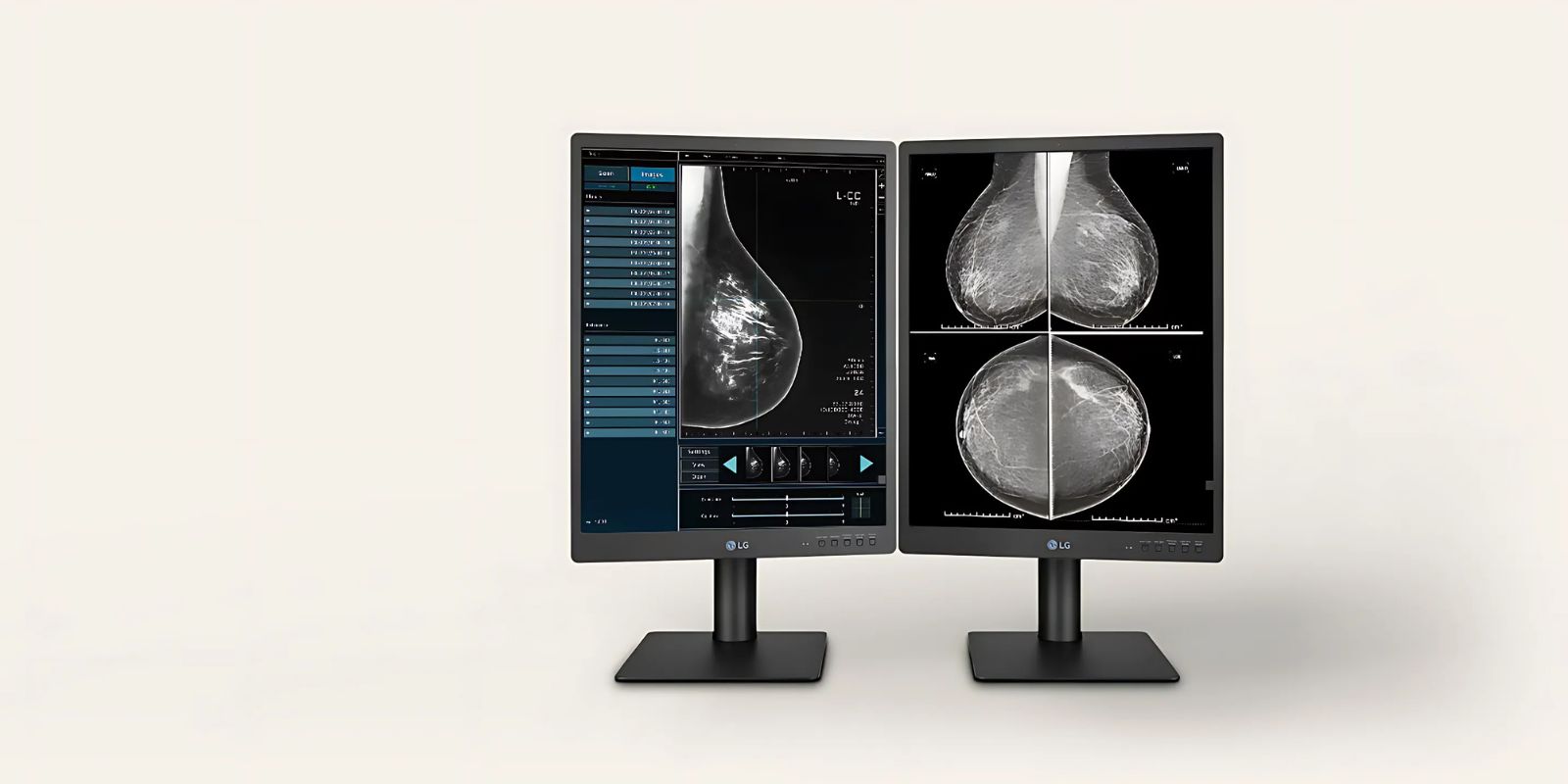 Monitor de diagnóstico IPS LG de 21,3