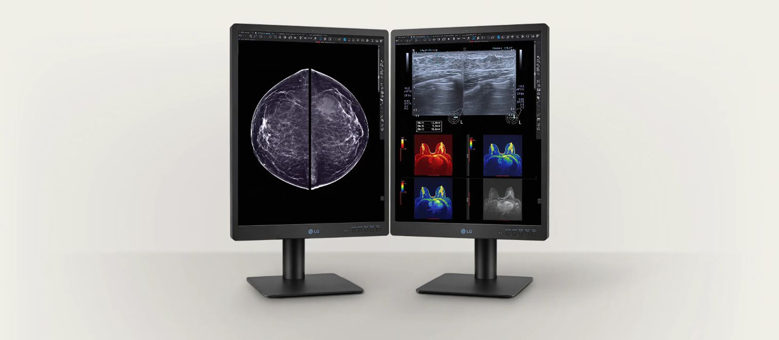 Monitor de diagnóstico IPS LG de 21,3