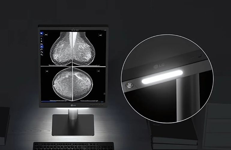 Monitor de diagnóstico IPS LG de 21,3