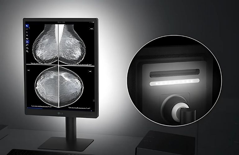 Monitor de diagnóstico IPS LG de 21,3