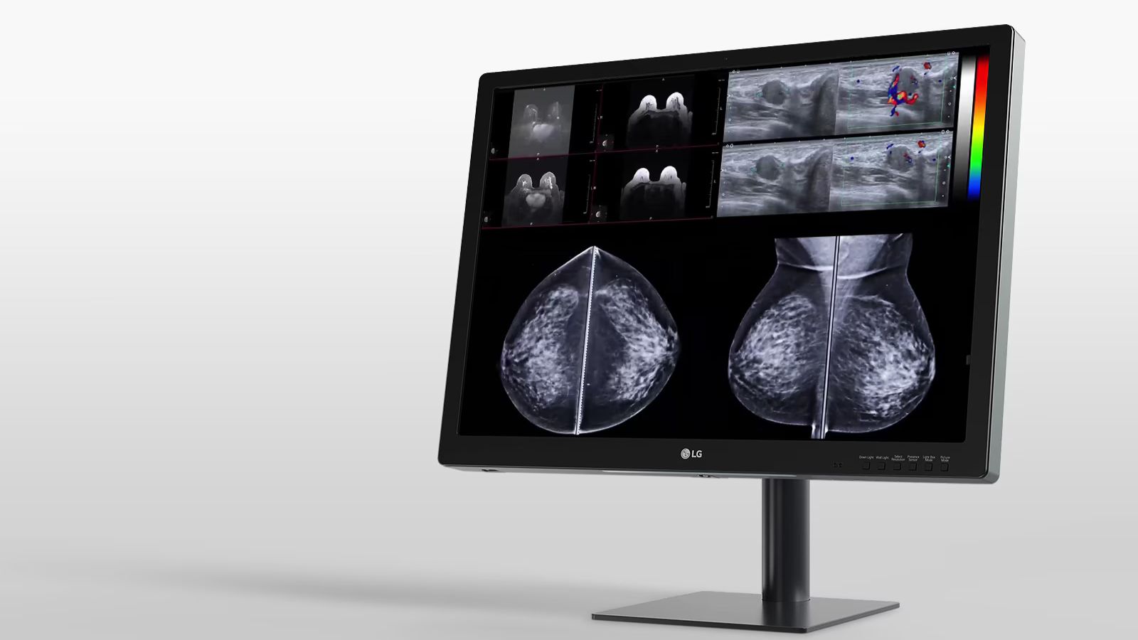 Monitor de Diagnóstico para Mamografía de 31 pulgadas y 12 MP