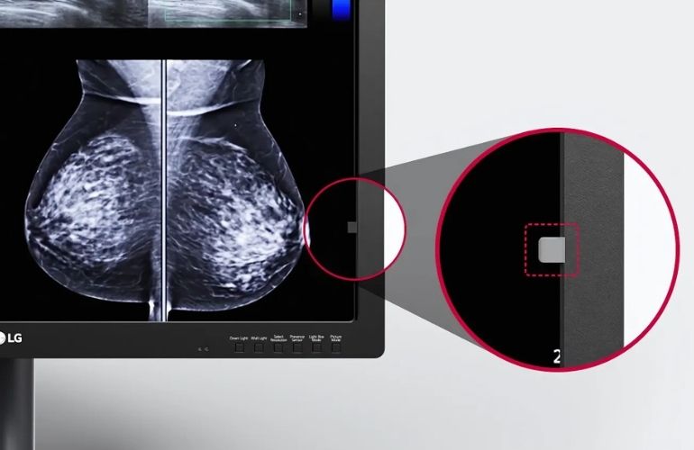 Monitor de Diagnóstico para Mamografía de 31 pulgadas y 12 MP