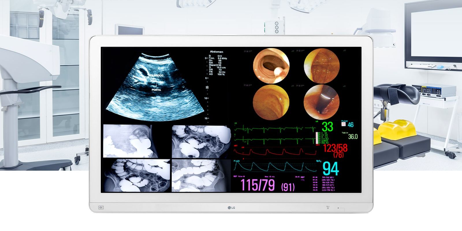 monitor-quirurgico-ips-4k-315-1 Monitor quirúrgico IPS 4K de 31,5'' de LG