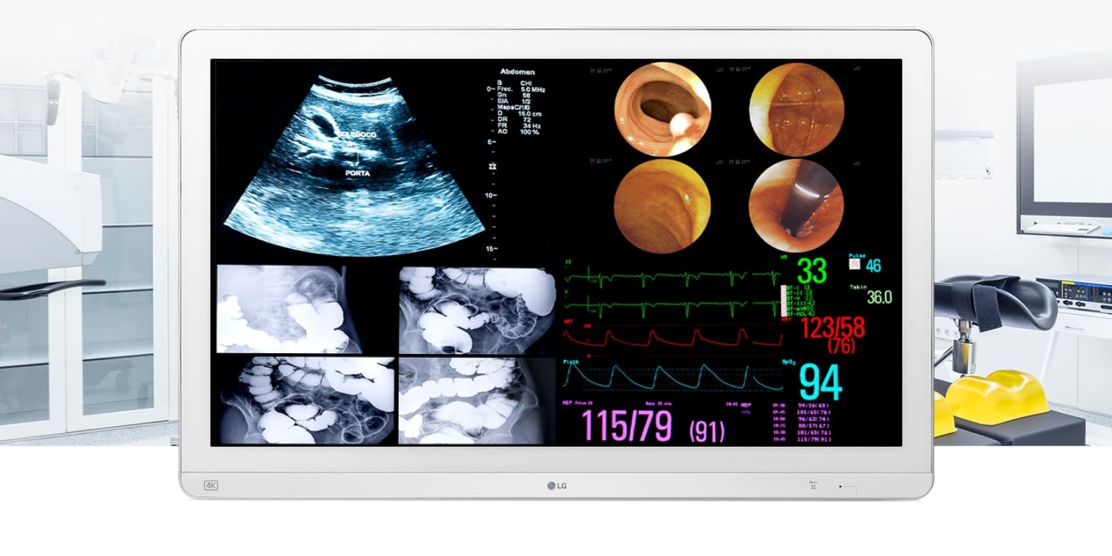 Monitor Quirúrgico IPS 4K de 31,5'' de LG