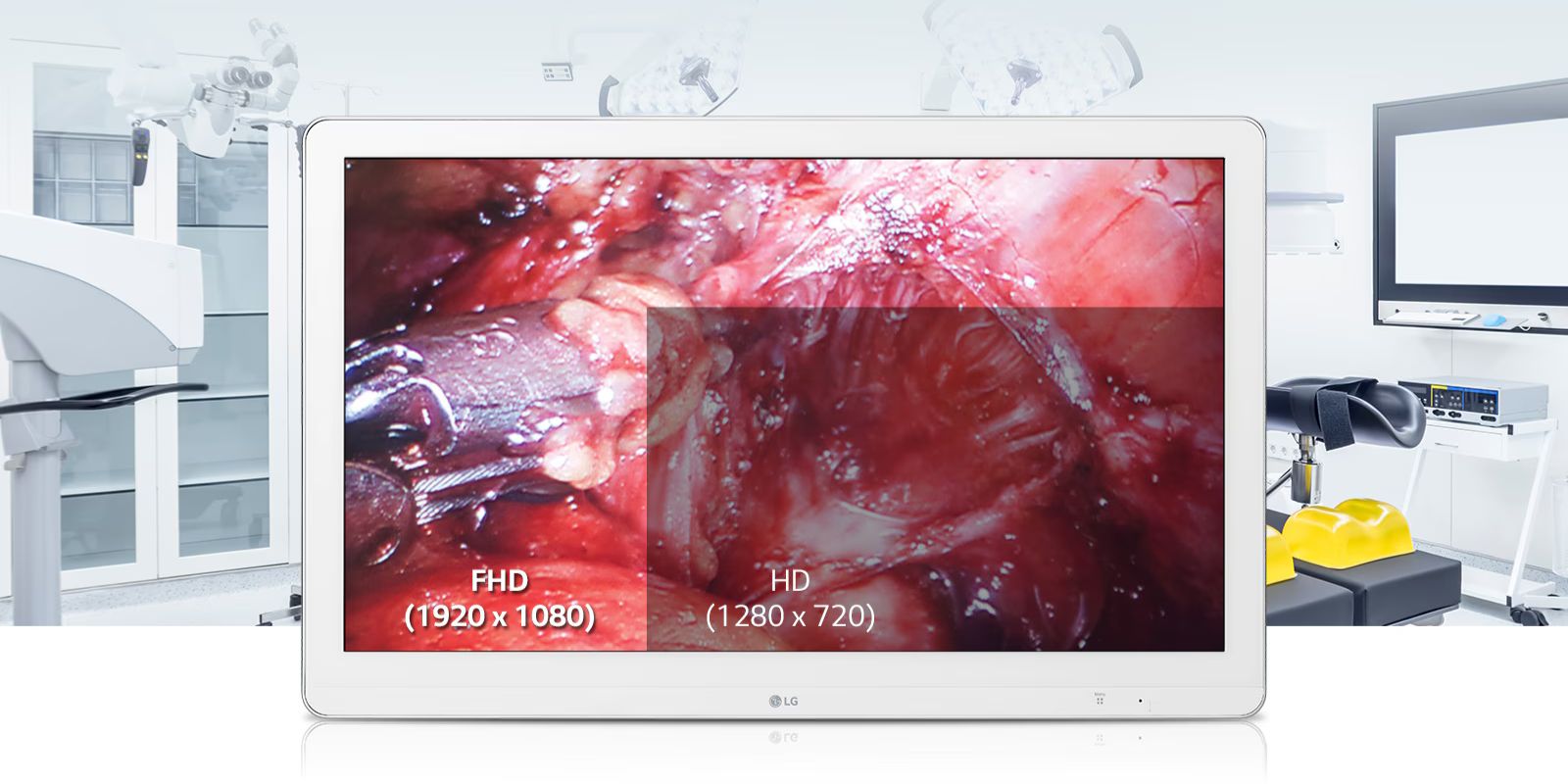 Monitor quirúrgico IPS Full HD de 27'' de LG