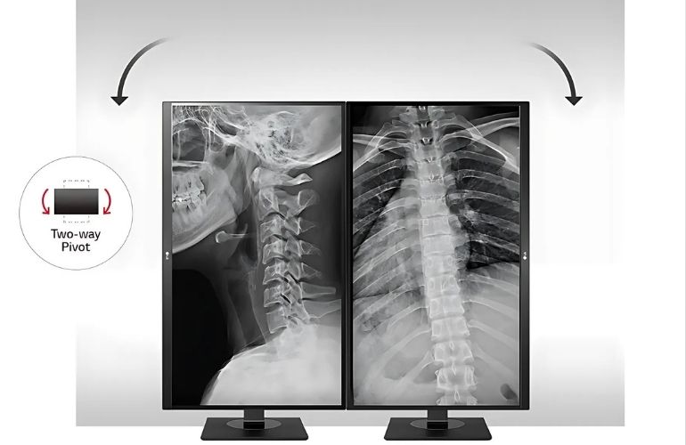 Monitor de revisión clínica IPS LG de 27'' y 8 MP