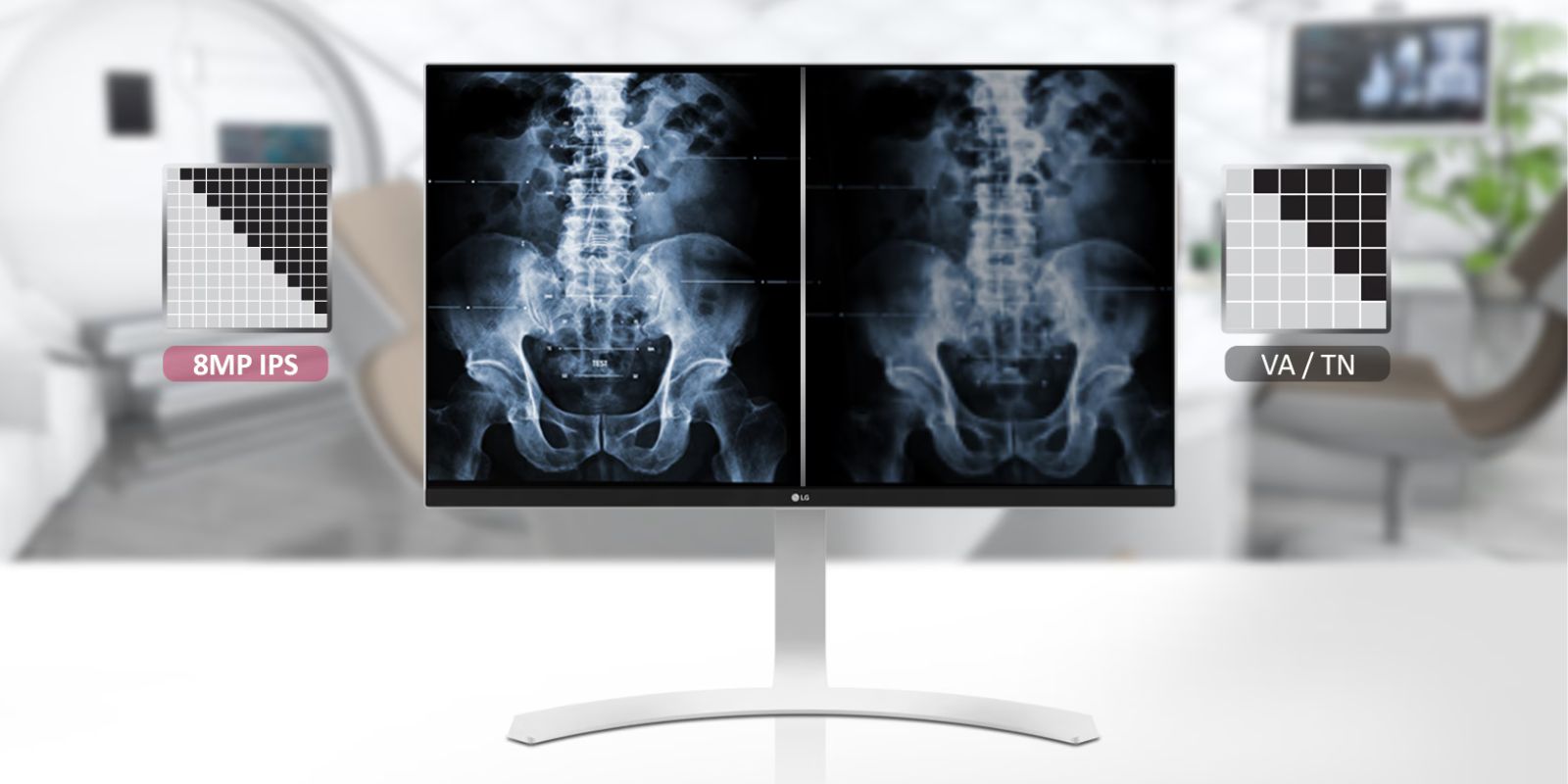 Monitor de Revisión Clínica Blanco IPS LG de 27'' y 8 MP